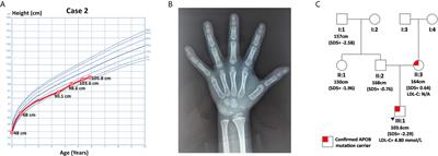 Case Report: A Clinical and Genetic Analysis of Childhood Growth Hormone Deficiency With Familial Hypercholesterolemia